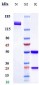 Anti-SOST / Sclerostin Reference Antibody (romosozumab)