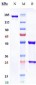 Anti-Rabies virus GP Reference Antibody (foravirumab)