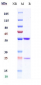 Anti-IL-1b Reference Antibody (CDP484)