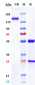 Anti-ROR2 Reference Antibody (ozuriftamab vedotin)