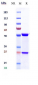 Anti-IL-21 Reference Antibody (avizakimab)