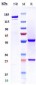 Anti-CD20 Reference Antibody (divozilimab)