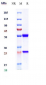 Anti-IL-13 Reference Antibody (dectrekumab)