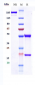 Anti-IGF1R / CD221 Reference Antibody (figitumumab)
