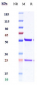 Anti-IL-18 Reference Antibody (ABT-325)