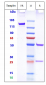 Anti-158P1D7 Reference Antibody (Agensys patent anti-158P1D7)