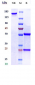 Anti-Amyloid Beta Reference Antibody (Merck patent anti-Amyloid Beta)
