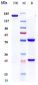 Anti-Amyloid Beta Reference Antibody (Rockefeller U. patent anti-Amyloid Beta)