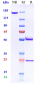 Anti-Amyloid Beta Reference Antibody (U.Zurich patent anti-Amyloid Beta)