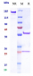 Anti-ASIC1 Reference Antibody (Regeneron patent anti-ASIC1)