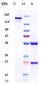 Anti-CD5 Reference Antibody (Magenta patent anti-CD5)