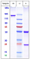 Anti-Cdiff Toxin A Reference Antibody (actoxumab)