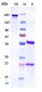 Anti-Complement Factor P / Properdin Reference Antibody (Novelmed patent anti-Properdin)