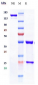 Anti-CSF2 / GM-CSF Reference Antibody (otilimab)
