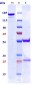 Anti-CSF2 / GM-CSF Reference Antibody (Theraclone patent anti-GM-CSF)