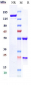 Anti-FOLH1 / PSMA Reference Antibody (rosopatamab-MMAE)