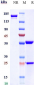 Anti-GIPR Reference Antibody (Amgen patent anti-GIPR)