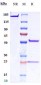 Anti-IL-25 Reference Antibody (Centocor patent anti-IL-25)