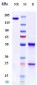 Anti-KIR2DL1 / CD158a Reference Antibody (Innate patent anti-KIR2DL)