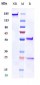 Anti-KLK5 / Kallikrein 5 Reference Antibody (Genentech patent anti-KLK5)