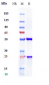 Anti-Mesothelin Reference Antibody (NIH patent anti-Mesothelin)