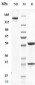 Anti-NGF / bNGF Reference Antibody (Izenivetmab)