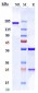 Anti-PCSK9 Reference Antibody (Merck patent anti-PCSK9)