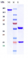 Anti-PDCD1 / PD-1 / CD279 Reference Antibody (UCB patent anti-PD-1)