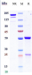 Anti-PDGFB Reference Antibody (MOR-8457)