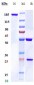 Anti-RSPO1 Reference Antibody (Oncomed patent anti-RSPO1)
