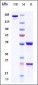 Anti-Shiga toxin (E.coli) Reference Antibody (pritoxaximab)