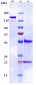 Anti-TNFRSF10B / TRAILR2 / CD262 Reference Antibody (tilogotamab)