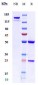 Anti-VEGFR1 / FLT1 Reference Antibody (Abbott patent anti-Flt1)
