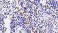 PD-L1 Antibody（immunohistochemistry）