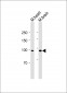 LPR1(S4520) Antibody