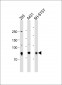 RPS6KA6 antibody