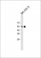 WT1 antibody