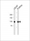 CD10 antibody