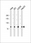 Caldesmon antibody
