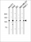 ROR1 Antibody