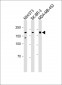 HER2 Antibody