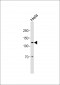 Anti-Progesterone Receptor antibody