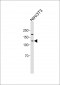 ROR1 antibody (C-term)