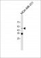 MEK1(S218/222) Antibody