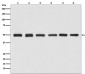Anti-beta Tubulin Rabbit Monoclonal Antibody, HRP Conjugated