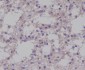 Anti-Phospho-TrkB (Y817) NTRK2 Rabbit Monoclonal Antibody