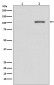 Anti-Phospho-IRE1 (S724) ERN1 Rabbit Monoclonal Antibody
