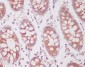 Anti-Phospho-SIRT1 (S47) Rabbit Monoclonal Antibody