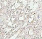 Anti-Phospho-AKT1 (T450) Rabbit Monoclonal Antibody