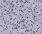 Anti-Phospho-c-Jun (S63) Rabbit Monoclonal Antibody